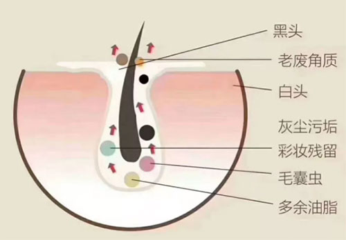 皮膚殘留狀況 為什么要定期做皮膚深層清潔?