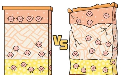 敏感性皮膚產(chǎn)生的原因是什么？
